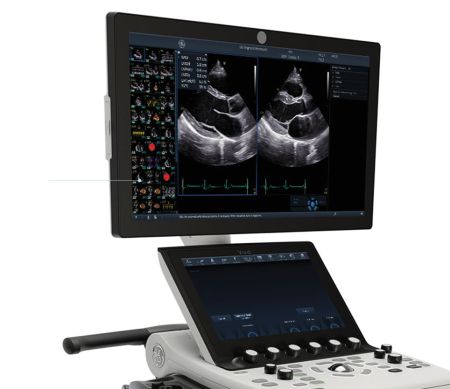 Vivid S70N Dimension Ultra Edition 